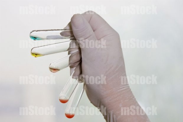 Mano sosteniendo tubos con líquido y muestras