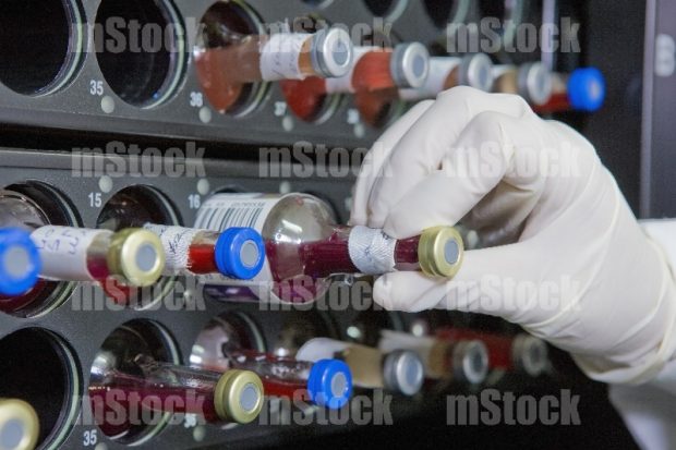Muestras de líquidos en la Industria Alimentaria
