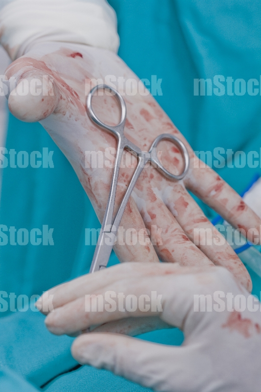 Doctor con pinzas en Quirófano