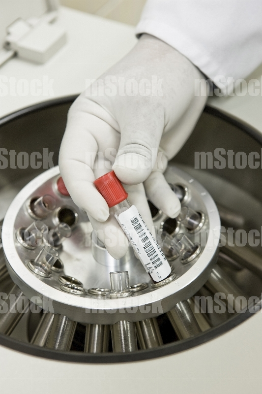 Doctor poniendo tubo de sangre en máquina centrífuga 1