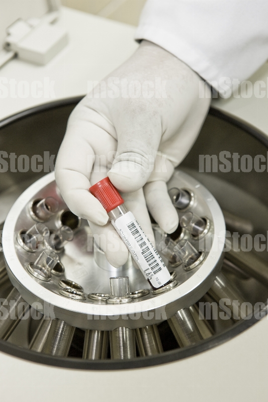 Doctor poniendo tubo de sangre en máquina centrífuga