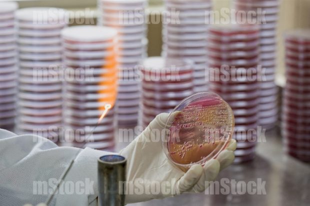 Colonias de bacterias en medios de cultivo