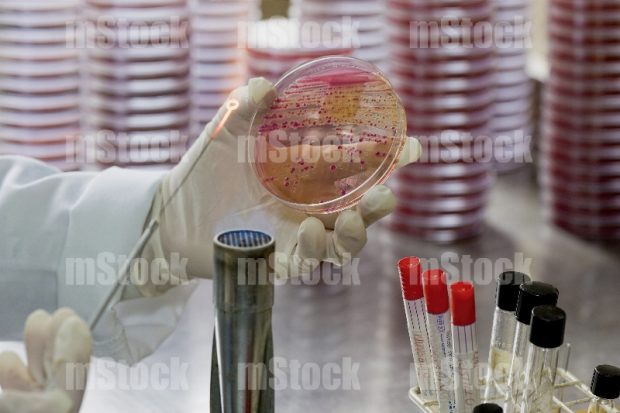 Crecimiento de colonias de bacterias