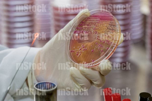 Cultivo de colonias bacterianas