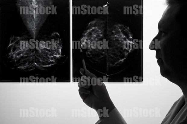 Doctor interpretando Radiografía