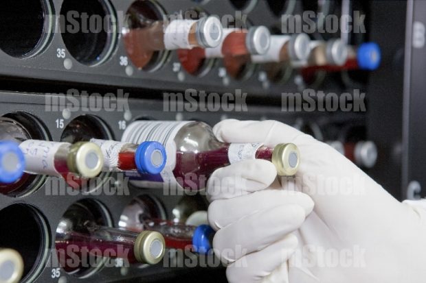 Muestras de hemocultivos